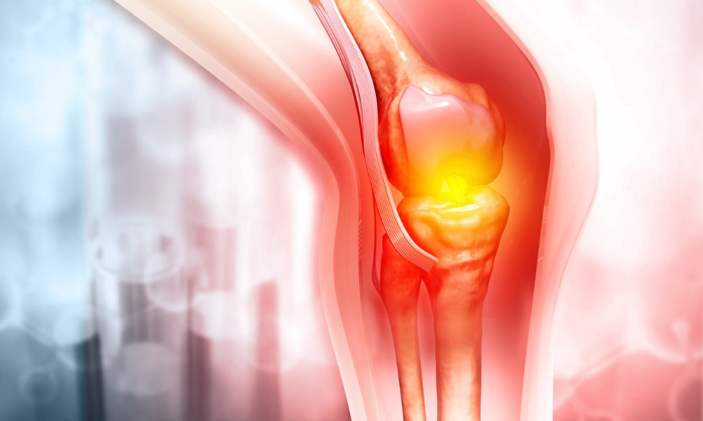 osteoarthritis joint pain and collagen supplements