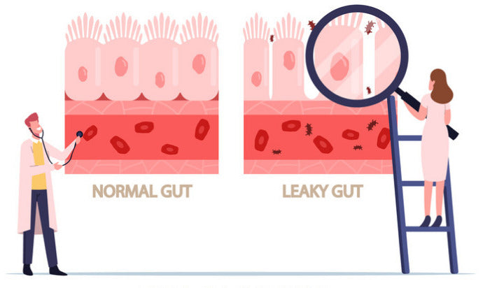 The Truth About Leaky Gut