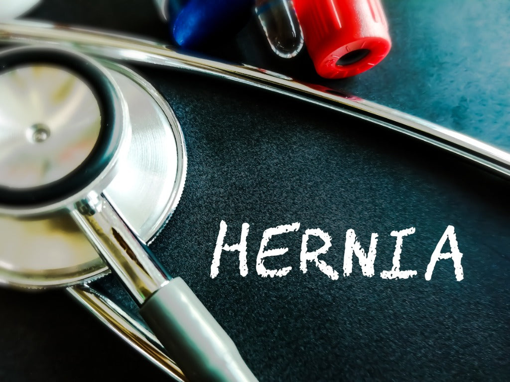 Understanding Hernias: Causes, Risks, and Prevention