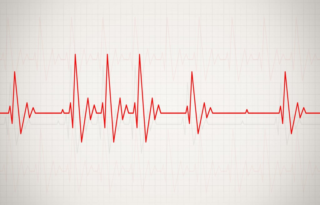 Arrhythmias are disruptions in your heart's usual beat. This can show up as beats that are too fast, too slow, or irregular, and are commonly experienced as palpitations