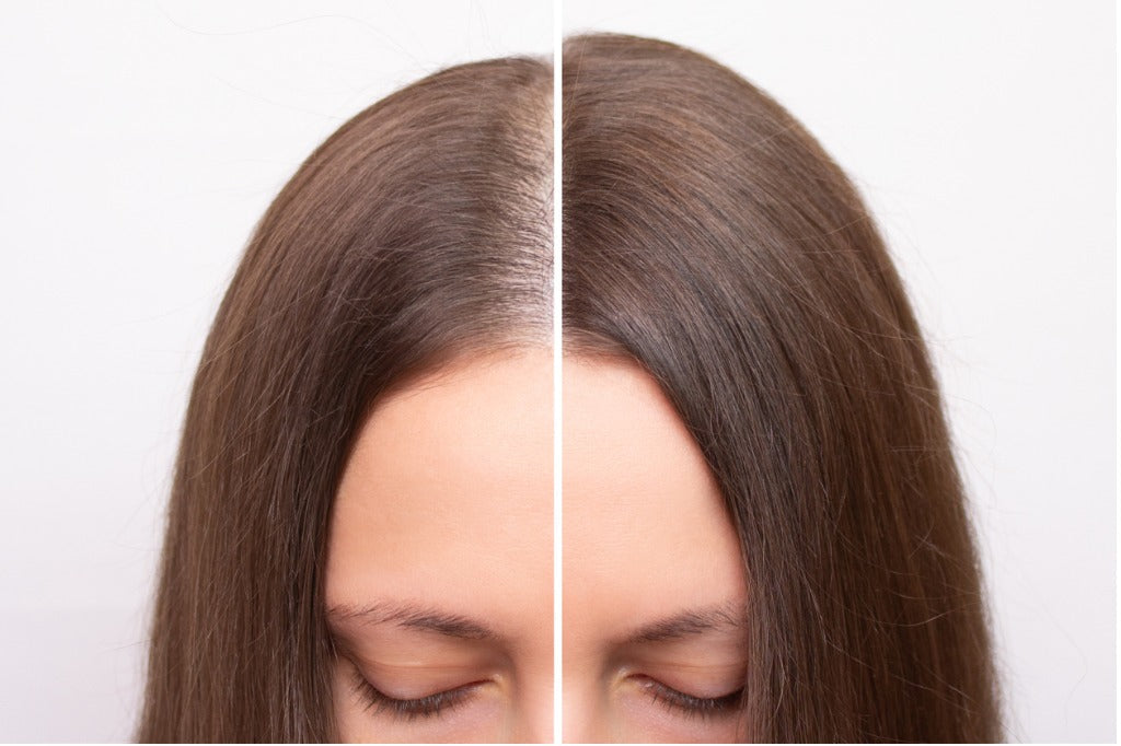 Hair loss in Women: causes and treatment